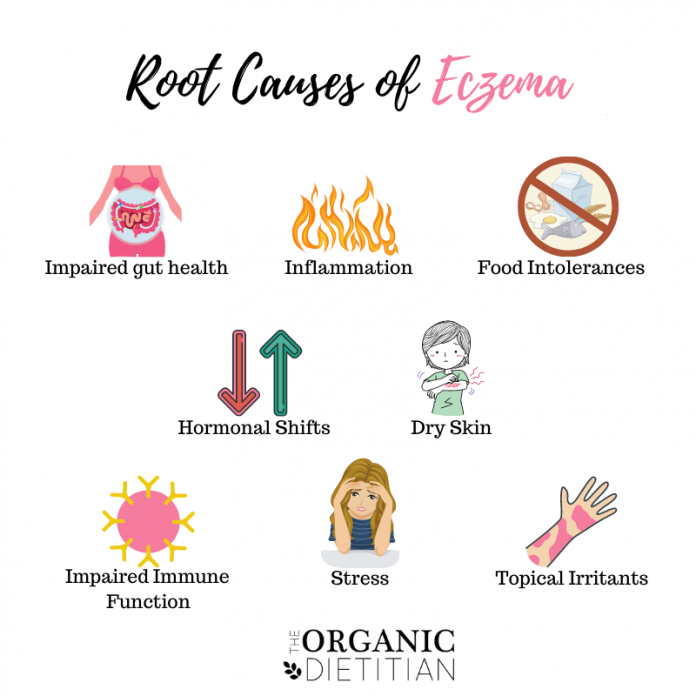 7-root-causes-of-eczema-how-to-start-healing-your-skin-from-within