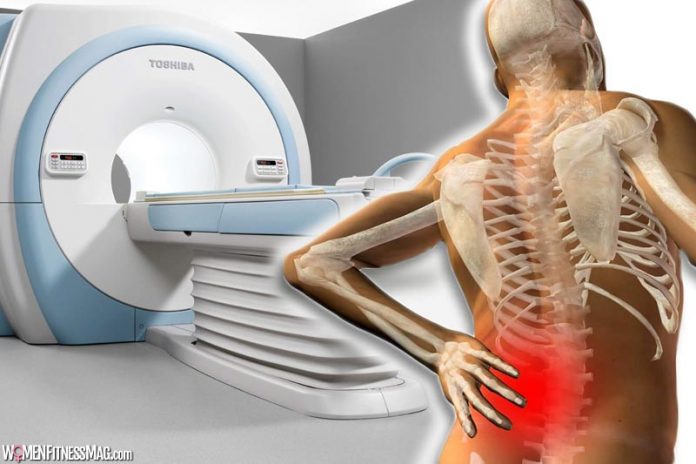 MRI For Patients With Lower Back Pain When It Is Necessary Evesfit