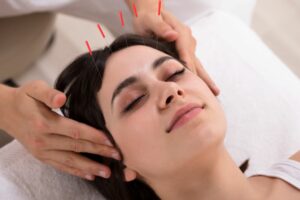 acupuncture for hay fever symptoms
